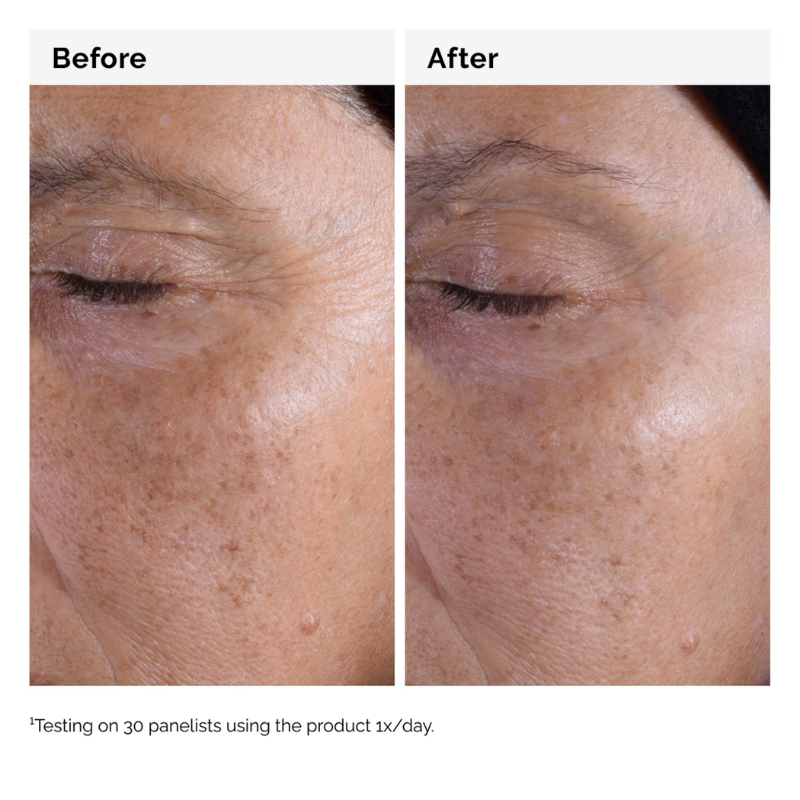 أورديناري -تونر حمض الجليكوليك - Image 3